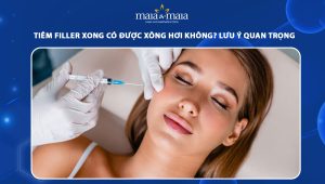 Tiêm filler xong có được xông hơi không? Lưu ý quan trọng sau tiêm 79 tiêm filler xong có được xông hơi không