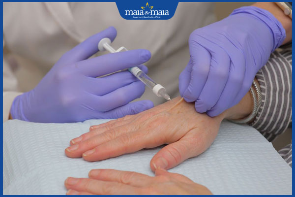 Tiêm filler bàn tay: Giải pháp trẻ hóa tay an toàn, hiệu quả  4 tiến hành tiêm filler bàn tay