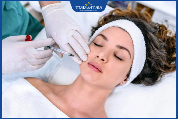 chọn tiêm filler rãnh cười