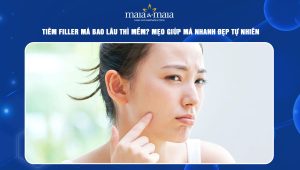 Tiêm filler má bao lâu thì mềm? Mẹo giúp má nhanh đẹp tự nhiên 54 tiêm filler má bao lâu thì mềm