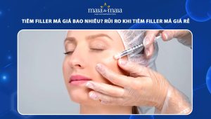Tiêm filler má giá bao nhiêu? Rủi ro khi tiêm filler má giá rẻ 49 tiêm filler má giá bao nhiêu