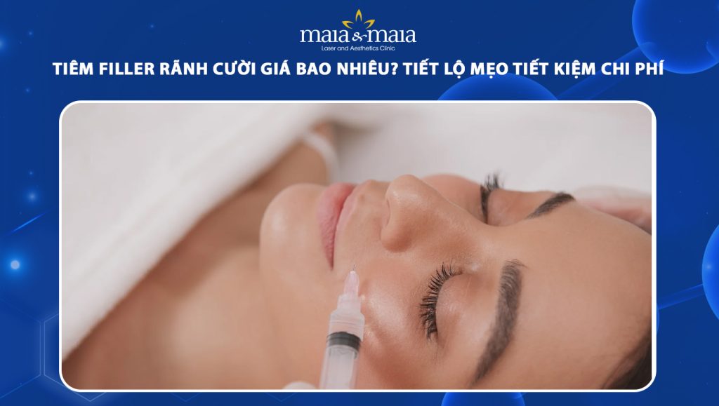 tiêm filler rãnh cười giá bao nhiêu
