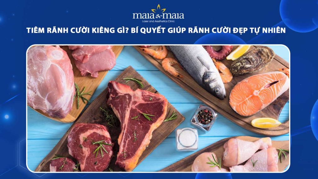 tiêm rãnh cười kiêng gì