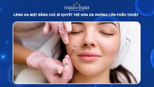 Căng da mặt bằng chỉ: Bí quyết trẻ hóa da không cần phẫu thuật 85 căng da mặt bằng chỉ