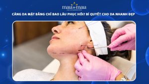 Căng da mặt bằng chỉ bao lâu phục hồi? Bí quyết cho da nhanh đẹp 60 căng da mặt bằng chỉ bao lâu phục hồi