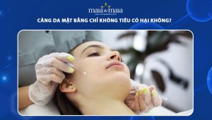 Căng da mặt bằng chỉ không tiêu có hại không? 41 căng da mặt bằng chỉ không tiêu có hại không
