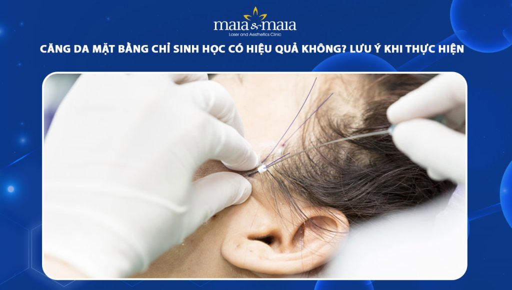 căng da mặt bằng chỉ sinh học