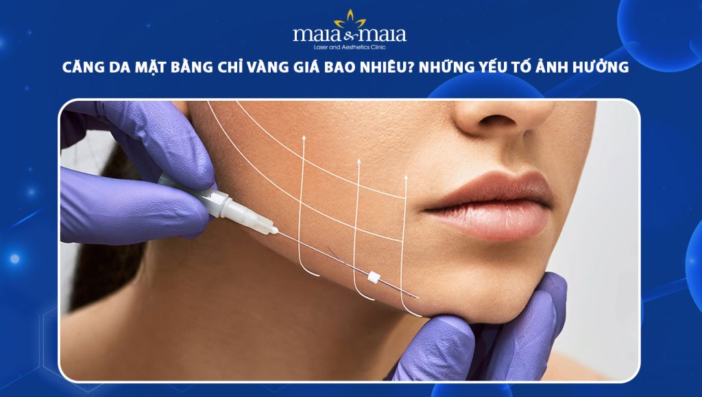 căng da mặt bằng chỉ vàng giá bao nhiêu