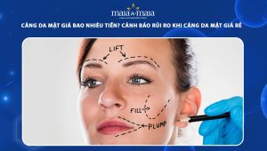 Căng da mặt giá bao nhiêu tiền? Cảnh báo rủi ro khi căng da mặt giá rẻ 77 căng da mặt giá bao nhiêu tiền
