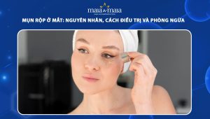 Hướng dẫn cách chăm sóc da sau tiêm meso đơn giản tại nhà 43 chăm sóc da sau tiêm meso