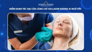 Điểm danh tác hại của căng chỉ collagen không ai ngờ tới!  46 tác hại của căng chỉ collagen