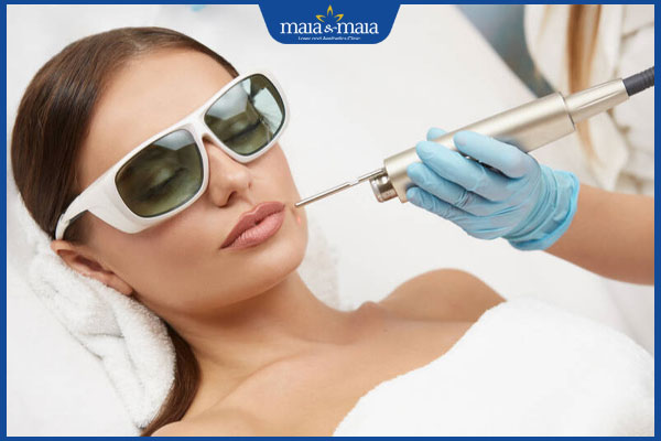 thực hiện căng da mặt 4d