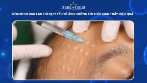 Tiêm meso bao lâu thì đẹp? Yếu tố ảnh hưởng tới thời gian thấy hiệu quả 32 tiêm meso bao lâu thì đẹp