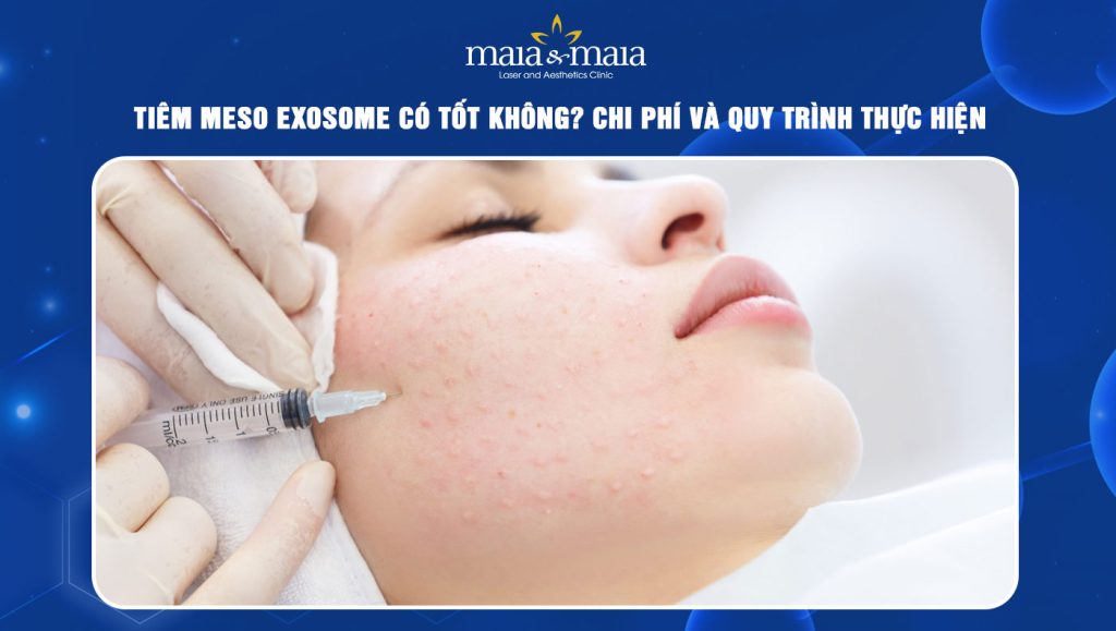 Tiêm Meso Exosome