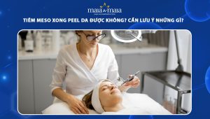 Tiêm meso xong peel da được không? Cần lưu ý những gì? 63 tiêm meso xong peel da được không