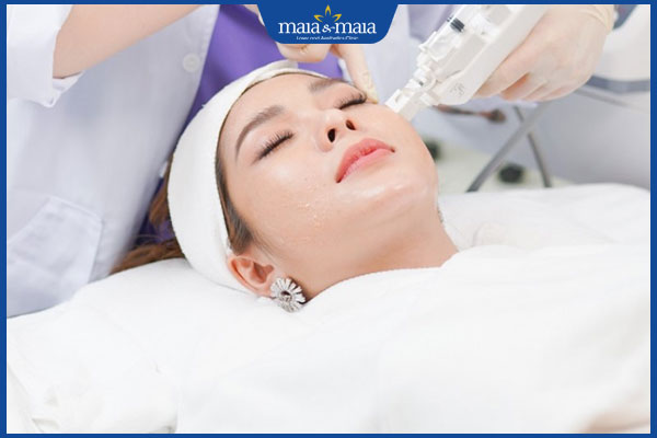 cấy meso không kim