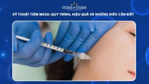Kỹ thuật tiêm meso: Quy trình, hiệu quả và những điều cần biết  74 kỹ thuật tiêm meso