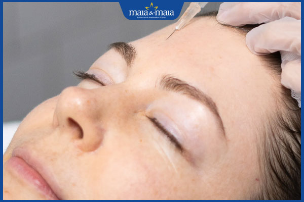 thực hiện tiêm meso trị mụn