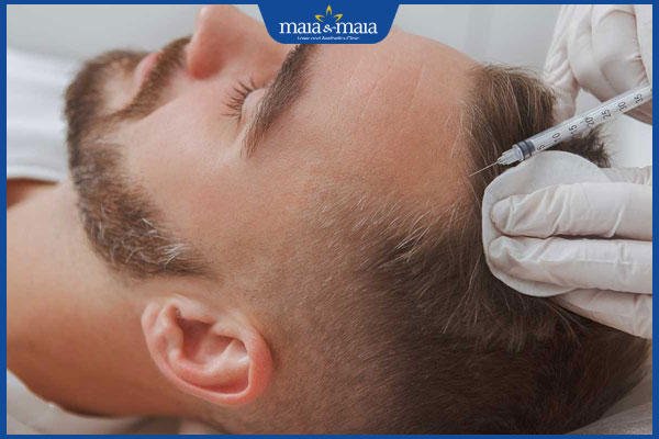 thực hiện tiêm meso trị rụng tóc