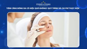 tiêm căng bóng da