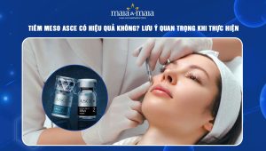 Tiêm Meso Asce có hiệu quả không? Lưu ý quan trọng khi thực hiện 36 tiêm Meso Asce