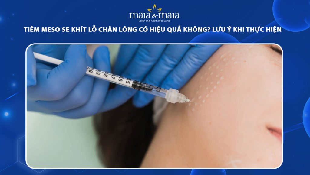 tiêm meso se khít lỗ chân lông