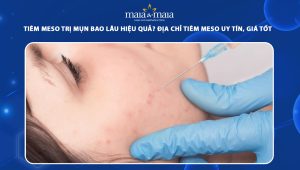 Tiêm meso trị mụn bao lâu hiệu quả? Địa chỉ tiêm meso uy tín, giá tốt 47 tiêm meso trị mụn
