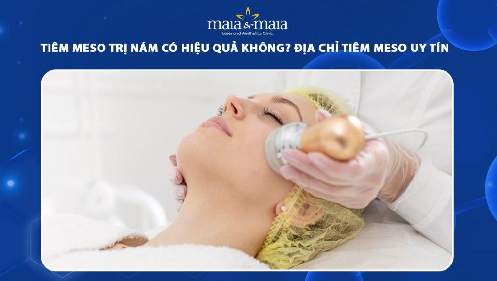 tiêm meso trị nám