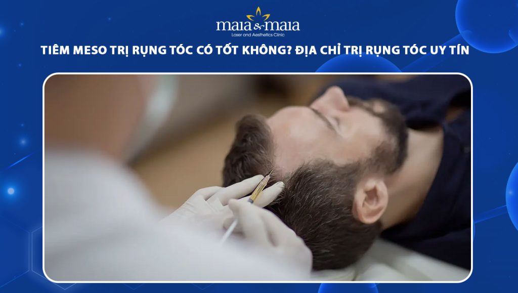 tiêm meso trị rụng tóc