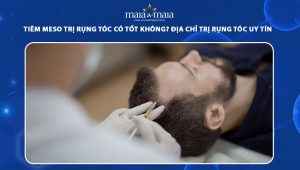 Tiêm meso trị rụng tóc có tốt không? Địa chỉ trị rụng tóc uy tín  81 tiêm meso trị rụng tóc