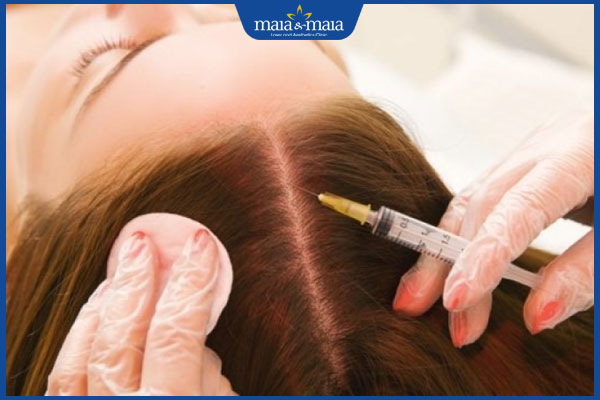 tiến hành tiêm meso trị rụng tóc