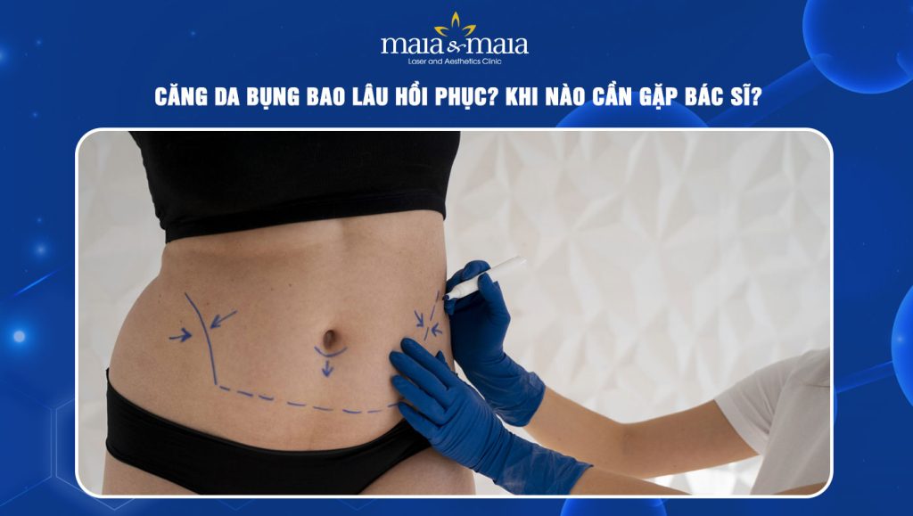 Căng da bụng bao lâu hồi phục