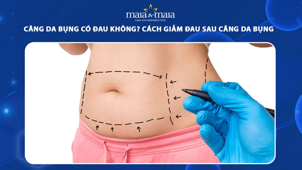 căng da bụng có đau không