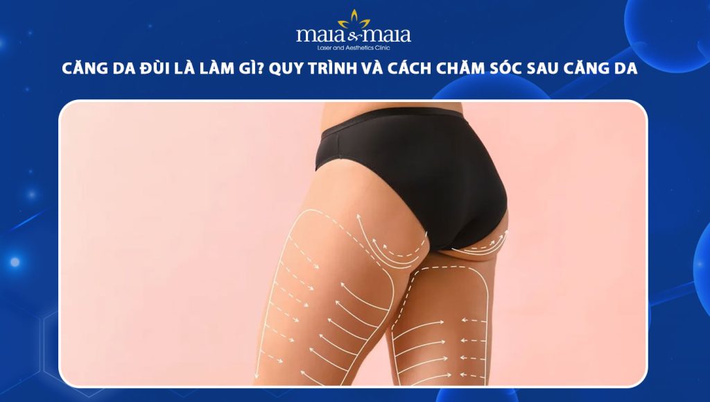 căng da đùi