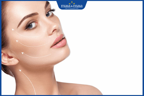 Căng da midface - Giải pháp trẻ hoá ưu việt cho mọi khách hàng 2 căng da midface là gì