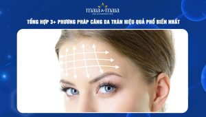 Tổng hợp 3+ phương pháp căng da trán hiệu quả phổ biến nhất 96 căng da trán