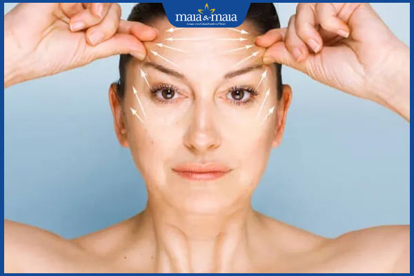 chi phí căng da trán