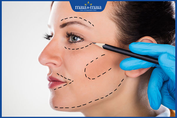 Có nên căng da mặt 3D không? Quy trình và chi phí phương pháp 4 chuẩn bị căng da mặt 3d