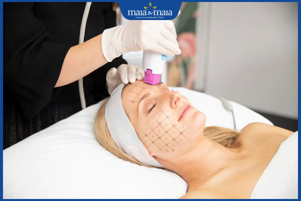 Công nghệ Thermage trẻ hóa tốt không? Quy trình và chi phí thực hiện 2 công nghệ thermage trẻ hoá làn da