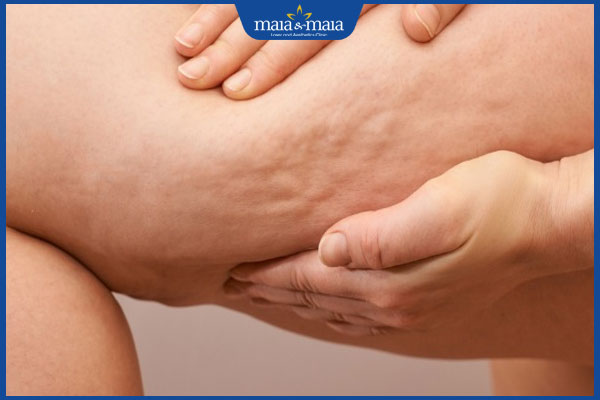 da đùi chảy xệ