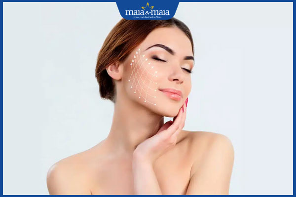 Cấy chỉ tơ tằm là gì? Ưu và nhược điểm khi cấy chỉ tơ tằm Chitossil 4 hiệu quả căng chỉ