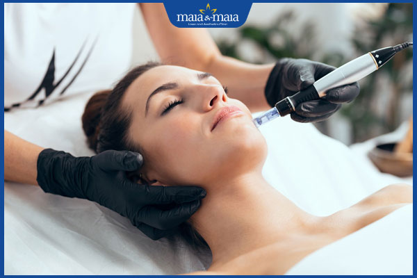 phương pháp vi kim căng bóng da