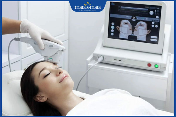 thực hiện công nghệ Ultherapy