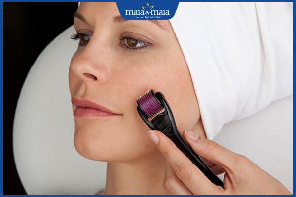 Lăn kim căng bóng da phù hợp với ai? Ưu điểm và tác dụng phụ 2 thực hiện lăn kim căng bóng da