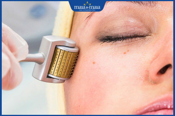 thực hiện lăn kim