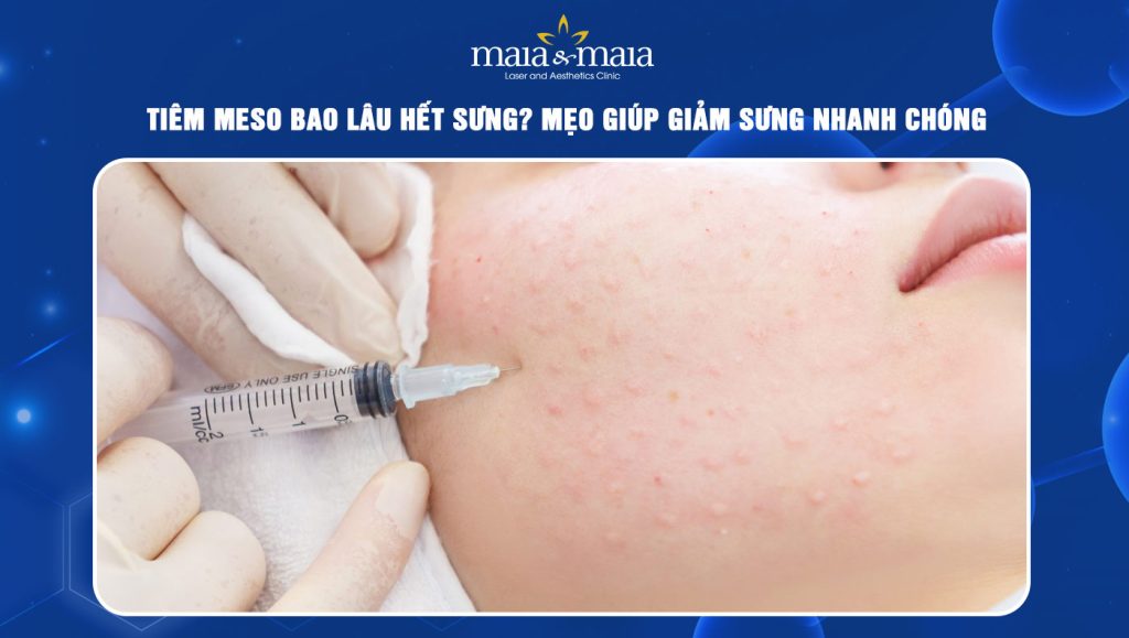 Tiêm meso bao lâu hết sưng