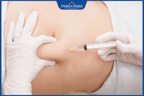 tiêm meso làm tan mỡ