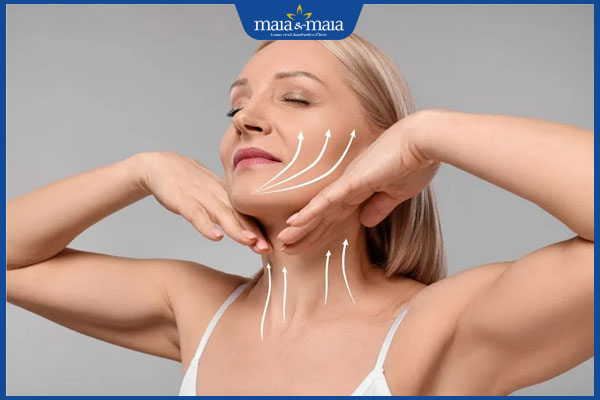 vị trí căng da mặt toàn phần