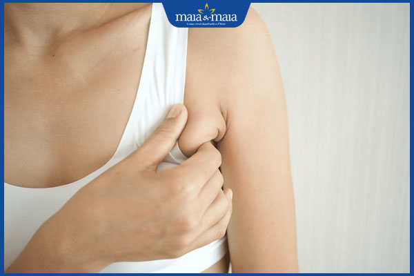 vùng nách chảy xệ