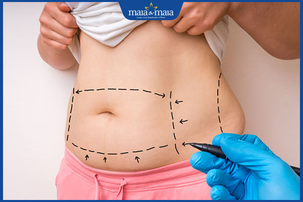 xác định vị trí phẫu thuật